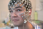 Neue Behandlungsmethoden bei Epilepsie