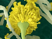 Elektronenmikroskopische Aufnahme des Schimmelpilzes Aspergillus flavus, der im menschlichen Körper schwache Organe schädigen kann.