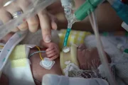 Neonatal_Baby