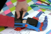 Preiswert und anpassungsfähig: Prothesen für Kinder aus dem 3D-Drucker