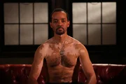 Ken Mead - Vitiligo.