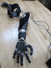Bionische Hand