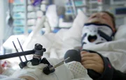 Viele Patienten landen nach schweren Unfällen auf der Intensivstation.