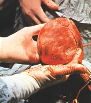 Das Herz ist ein sehr aktives und widerstandsfähiges Muskelorgan und wiegt im Durchschnitt gerade einmal 300 Gramm.