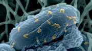 Bakteriophagen lassen sich gezielt gegen Antibiotika-resistente Keime einsetzen.