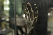 Picture Shows: Anatomical model of the hand.