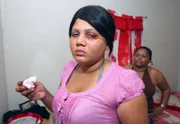 Picture Shows: Delfina Cedeno from the Dominican Republic suffers from mystery bleeding