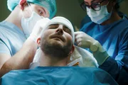 Haartransplantation