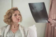 Lady Felicia (Nancy Carroll) kann auf dem Röntgenbild die Auswirkungen ihres Unfalls sehen. Sie ist mit leichten Verletzungen davongekommen.