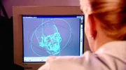 Fall "Die Teppich-Leiche": Rechtsmedizinerin Dr. Katja Jachau aus Magdeburg versucht mittels einer Superimposition, einer computeranimierten Bildüberlagerung, die Leiche zu identifizieren.