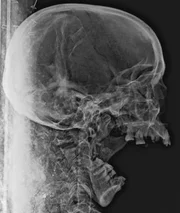 Röntgenbild der Mumie von Tadihor.