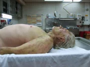 (3. Staffel) - In den USA zählt Dr. Jan Garavaglia zu den renommiertesten Pathologinnen. In "Dr. G  - Beruf: Gerichtsmedizinerin" gibt sie einen Einblick in ihre Arbeit und erklärt, wie sie zusammen mit ihrem Team bei der Lösung komplizierter Mordfälle hilft und medizinische Absonderlichkeiten aufklärt. Dr. G schildert auch für Laien verständlich wissenschaftliche Zusammenhänge und nimmt die Zuschauer mit in die spannende Welt der Rechtsmedizin ...