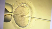 Artificial insemination
