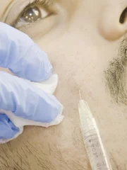 Rishi has fillers.