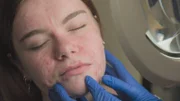 Close up profile of Kayleigh’s face as Dr Emma inspects it. Dr Emma’s hands in shot...