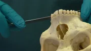 Dr. Harald Voß untersucht einen Schädel.
