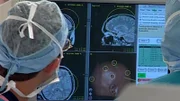 Bei Erwachsenen verläuft eine Cytomegalie in der Regel völlig harmlos. Bei Kleinkindern, deren Immunsystem noch nicht vollständig entwickelt ist, können jedoch lebensbedrohliche Krankheitsbilder auftreten - wie im Fall der elf Monate alten Lilian im US-Bundesstaat Texas. Das Mädchen leidet unter heftigen Anfällen, denn die Herpesviren sind in ihre Gehirnzellen eingedrungen. Mit Medikamenten ist den Parasiten dort nicht beizukommen, deshalb greifen Dr. Gail Harrison und ihre Medizinerkollegen in dieser Folge zu drastischen Maßnahmen.