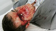 Bei seinen Ermittlungen wurde Ryan Wolfe (Jonathan Togo) Opfer eines Anschlags und sehr schwer verletzt. Der Täter benutzte eine Nagelpistole, wie auch schon bei Brenda Hall... Bei seinen Ermittlungen wurde Ryan Wolfe (Jonathan Togo) Opfer eines Anschlags und sehr schwer verletzt. Der Täter benutzte eine Nagelpistole, wie auch schon bei Brenda Hall...
