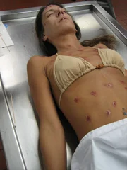 (1. Staffel) - Dr. Jan Garavaglia, eine der renommiertesten Pathologinnen in den USA, gibt einen Einblick in ihre Arbeit und erklärt, wie sie zusammen mit ihrem Team bei der Lösung komplizierter Mordfälle hilft und medizinische Absonderlichkeiten aufklärt.
