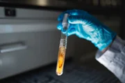Einzigartig in Deutschland ist die Stammsammlung von circa 50 000 Mikroorganismen der Jena Microbial Resource Collection (JMRC). Als eine der weltweit größten Sammlungen enthält sie Isolate von rund 15 000 Pilze und 35 000 Bakterien.