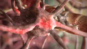 Eastern Equine Encephalitis.