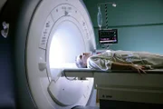 Der Lektor Nick (Jay Karnes) kränkt seine Mitmenschen mit seiner Ehrlichkeit. Als er bei einem Abendessen kollabiert, wird er ins Princeton Plainsboro eingeliefert.