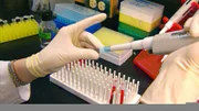Führt der DNA-Test zur Identifikation des Täters?