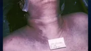 Opfer