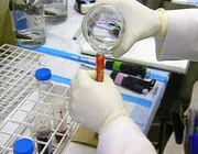 Mit der giftigen Substanz Excedrin reinigt man Aquarien. Hat Stella mit diesem Medikament versucht, die Lebensversicherung ihres Mannes zu kassieren?