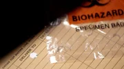 Biohazard-Probenbeutel
