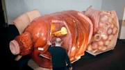 Begehbare Prostata