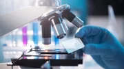 A scientist placing a slide under a microscope