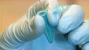 Ein Molekulargenetiker wird in einem Mordfall hinzugezogen. Er soll den Täter anhand der DNA überführen.