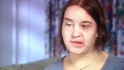 Vickis Gesicht ist für den Rest ihres Lebens entstellt. Als Kind wurde sie von einem Auto überfahren.
