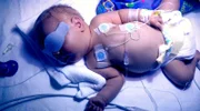 Moritz wurde als Baby im Krankenhaus falsch behandelt. Der Gerichtsprozess läuft seit 13 Jahren.