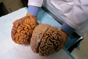 Brains donated For an aging study.