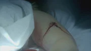 Wunde an einem toten Körper