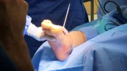 Due to a rare and dangerous disease, Jeffrey's feet have grown so huge that there are no more shoes for him to buy. Dr. Schaeffer is his last resort.