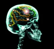 CGI IMAGE: Brain activity.