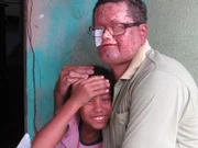 Sun intolerant villager with skin graft face with daughter.