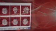 Gehirnscans