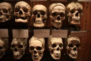 PHILADELPHIA, PA, USA: This collection of skulls resides in the Mutter Museum at the University of Pennsylvania College of Physicians.