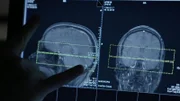 A brain scan