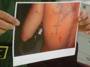 Inmate Stab Wounds