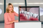 Wenn man schon einen Zahn verliert, so kann man in Zukunft über das Zahnimplantat nicht nur Lücken schließen, sondern auch dafür sorgen, dass der Rest des Gebisses von Karies verschont bleibt. Anja Reschke stellt die neuen High-Tech-Implantate vor – bei Wissen vor acht - Zukunft.