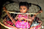 Lakshmi Tatma from India was born with a parasitic twin and became known as the girl with eight limbs