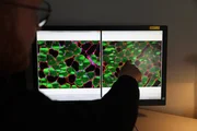 Muskelfasern unterm Mikroskop. Das Alter spielt beim Rückgang der Muskelmasse eine große Rolle.