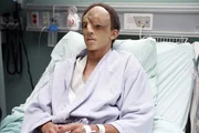 Kenny (Khleo Thomas) ist verzweifelt. Eine Wucherung in seinem Gesicht macht es ihm unmöglich ein normales Leben zu führen. Dr. House ist seine letzte Hoffnung...