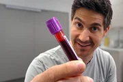Einstein Moderator Tobias Müller hat sein Blut für einen Test abnehmen lassen.