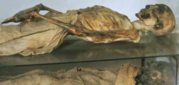 Mumie im Museum    +++ Die Verwendung des sendungsbezogenen Materials ist nur mit dem Hinweis und Verlinkung auf RTL+ gestattet. +++